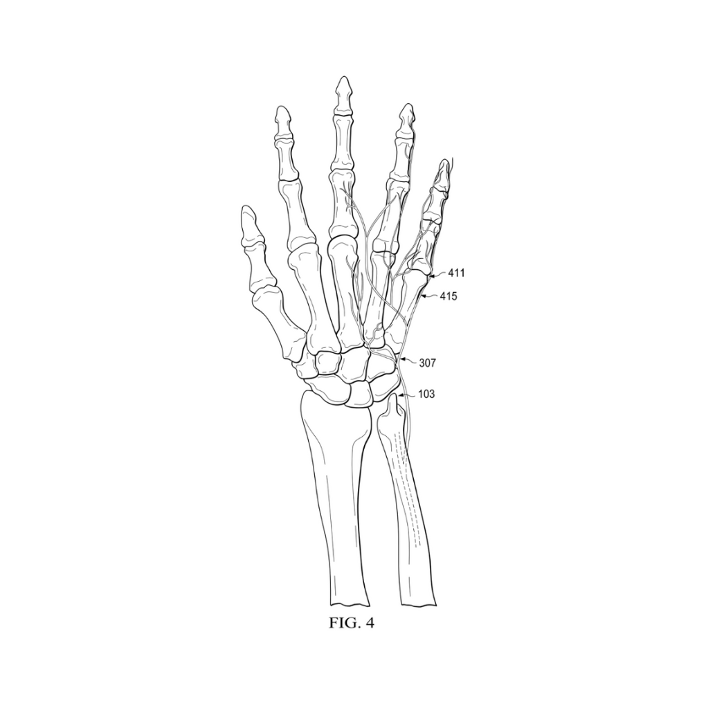 medical-bone-utility-patent-drawing